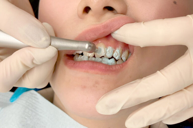 検査・クリーニング